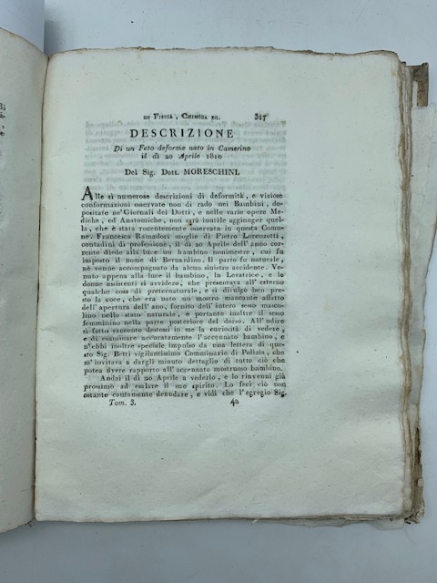 Descrizione di un feto deforme nato in Camerino il dì 20 aprile 1810 SEGUE Storia anatomica sopra un mostro umano bicorporeo